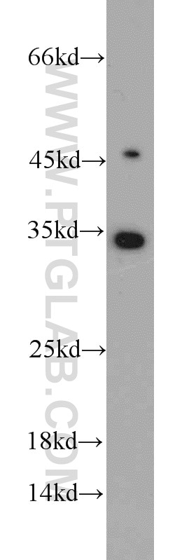 WB analysis of MCF-7 using 12271-1-AP