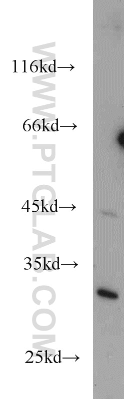 Western Blot (WB) analysis of MCF-7 cells using UCK1 Polyclonal antibody (12271-1-AP)