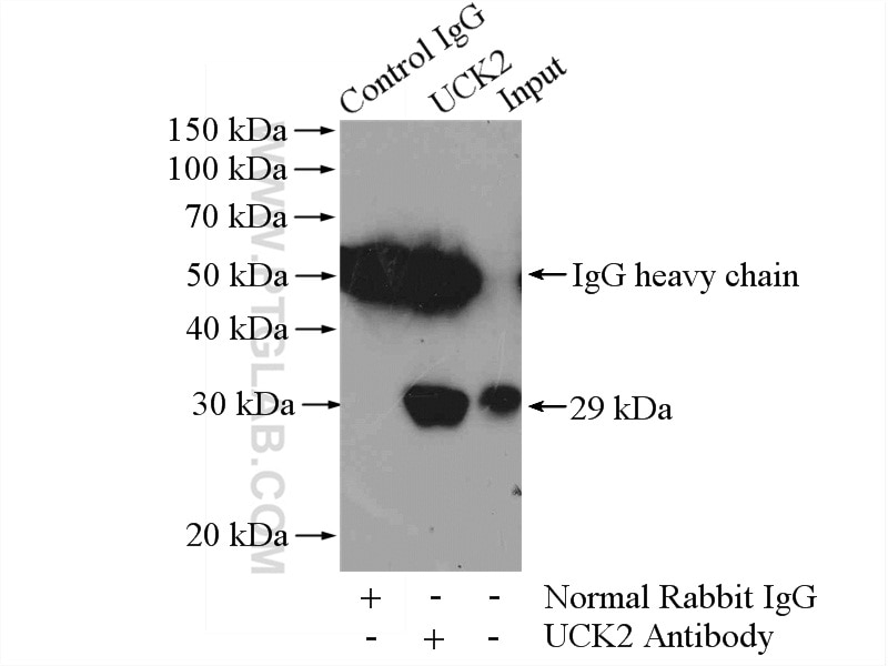 Immunoprecipitation (IP) experiment of Jurkat cells using UCK2 Polyclonal antibody (10511-1-AP)