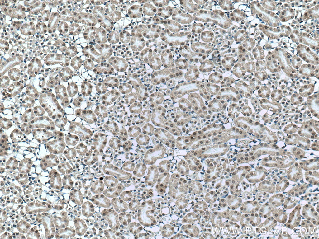 Immunohistochemistry (IHC) staining of mouse kidney tissue using UCKL1 Polyclonal antibody (17005-1-AP)
