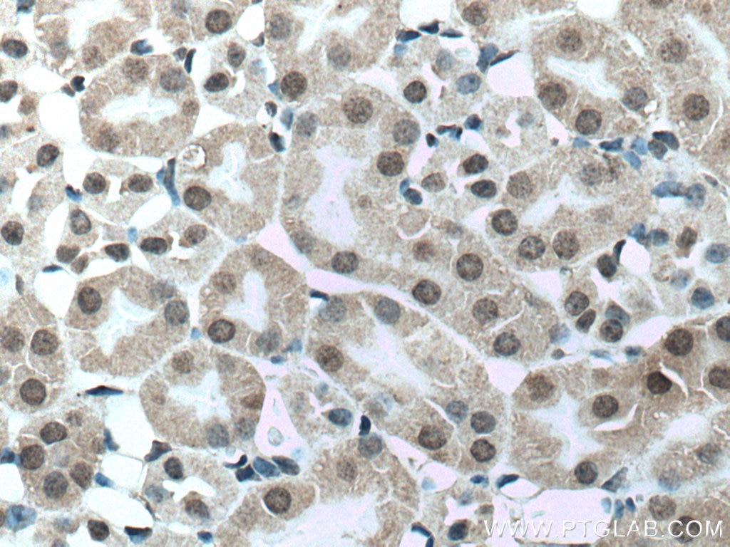 IHC staining of mouse kidney using 17005-1-AP
