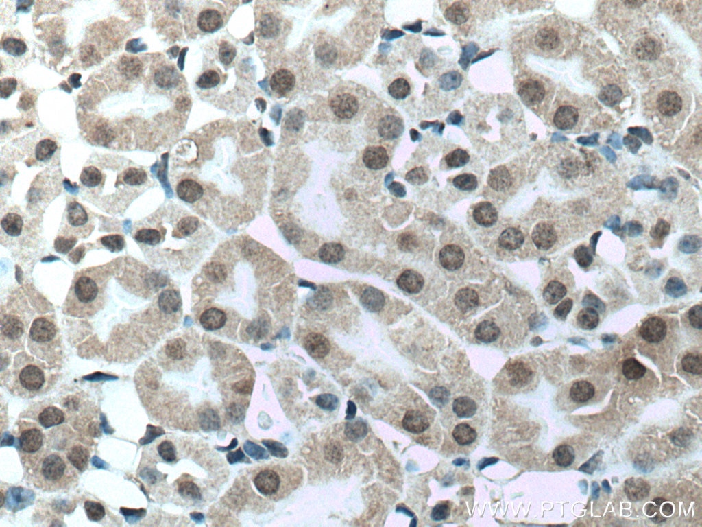 Immunohistochemistry (IHC) staining of mouse kidney tissue using UCKL1 Polyclonal antibody (17005-1-AP)