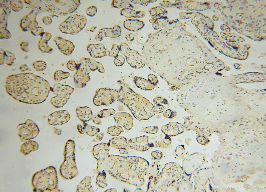 Immunohistochemistry (IHC) staining of human placenta tissue using UCKL1 Polyclonal antibody (17005-1-AP)