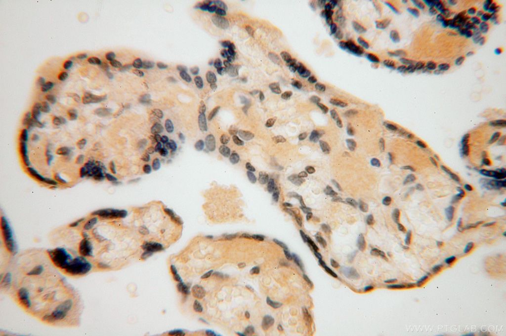 Immunohistochemistry (IHC) staining of human placenta tissue using UCKL1 Polyclonal antibody (17005-1-AP)