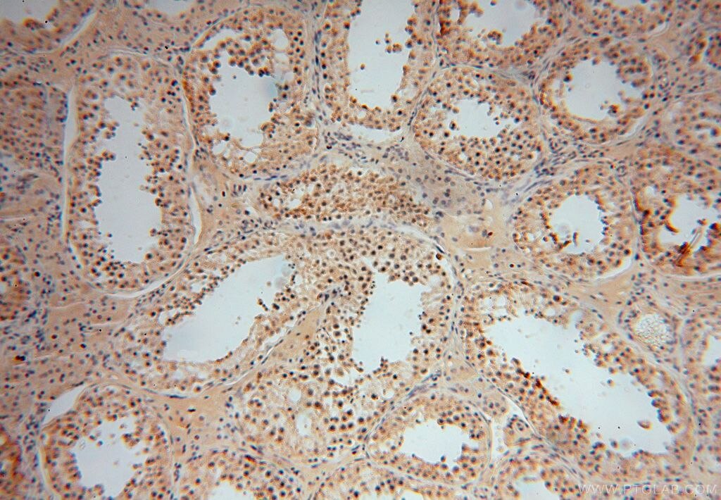 Immunohistochemistry (IHC) staining of human testis tissue using UCKL1 Polyclonal antibody (17005-1-AP)