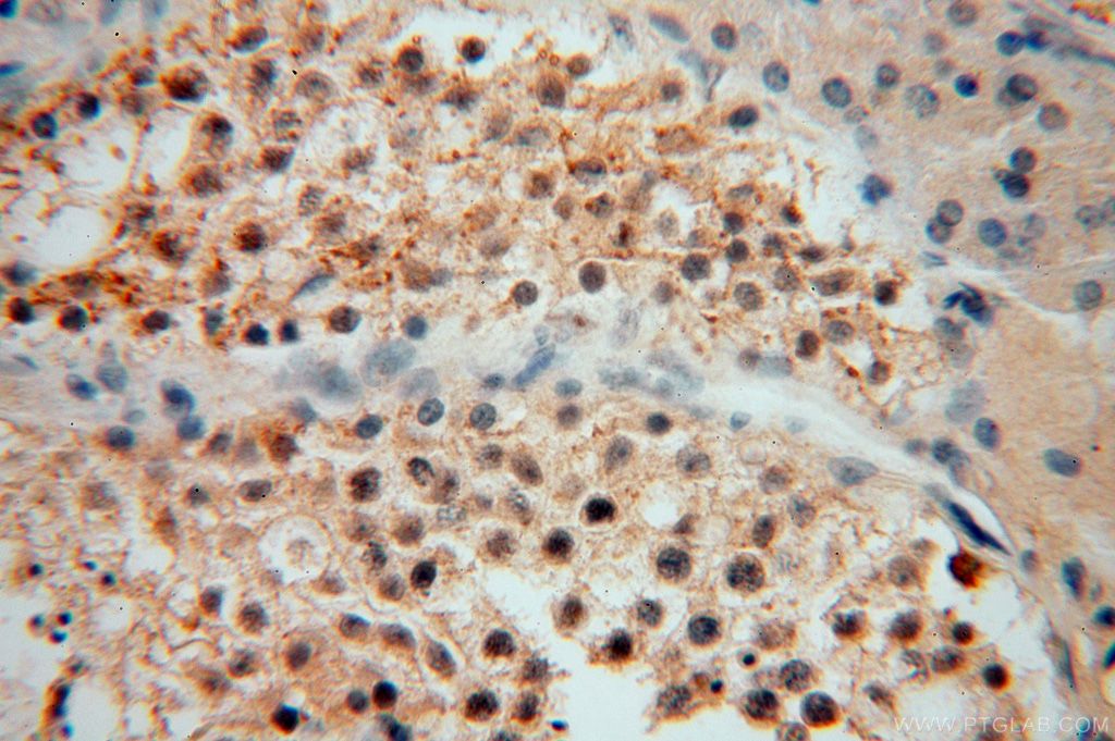 Immunohistochemistry (IHC) staining of human testis tissue using UCKL1 Polyclonal antibody (17005-1-AP)
