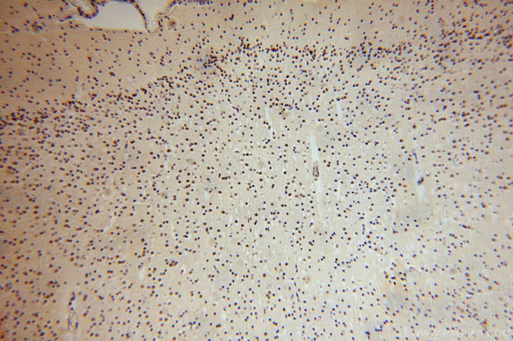 Immunohistochemistry (IHC) staining of human brain tissue using UCKL1 Polyclonal antibody (17005-1-AP)