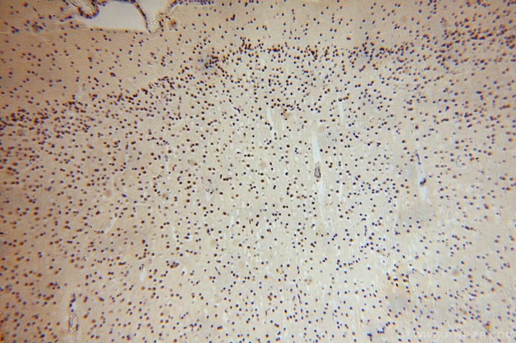 IHC staining of human brain using 17005-1-AP