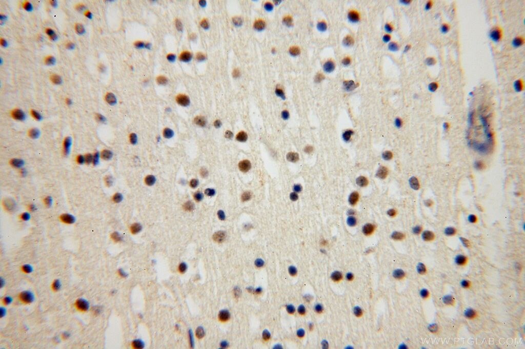 Immunohistochemistry (IHC) staining of human brain tissue using UCKL1 Polyclonal antibody (17005-1-AP)