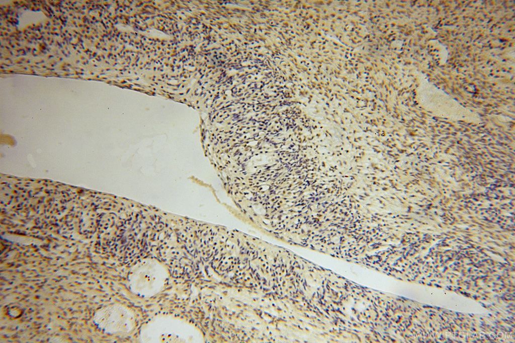 Immunohistochemistry (IHC) staining of human ovary tissue using UCKL1 Polyclonal antibody (17005-1-AP)