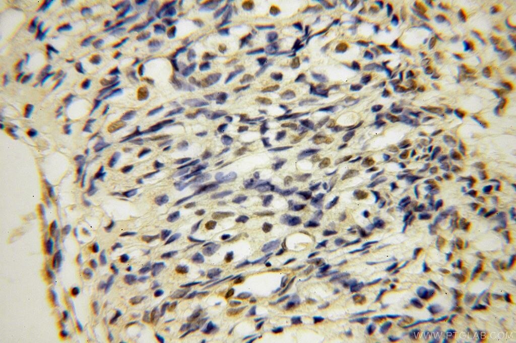 Immunohistochemistry (IHC) staining of human ovary tissue using UCKL1 Polyclonal antibody (17005-1-AP)