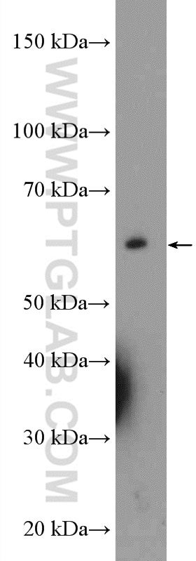 Western Blot (WB) analysis of rat kidney tissue using UCKL1 Polyclonal antibody (17005-1-AP)