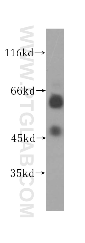 Western Blot (WB) analysis of K-562 cells using UCKL1 Polyclonal antibody (17005-1-AP)