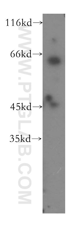 Western Blot (WB) analysis of Raji cells using UCKL1 Polyclonal antibody (17005-1-AP)
