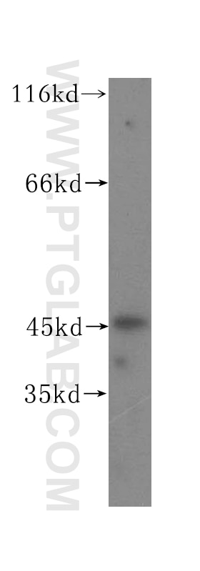 Western Blot (WB) analysis of U-937 cells using UCKL1 Polyclonal antibody (17005-1-AP)