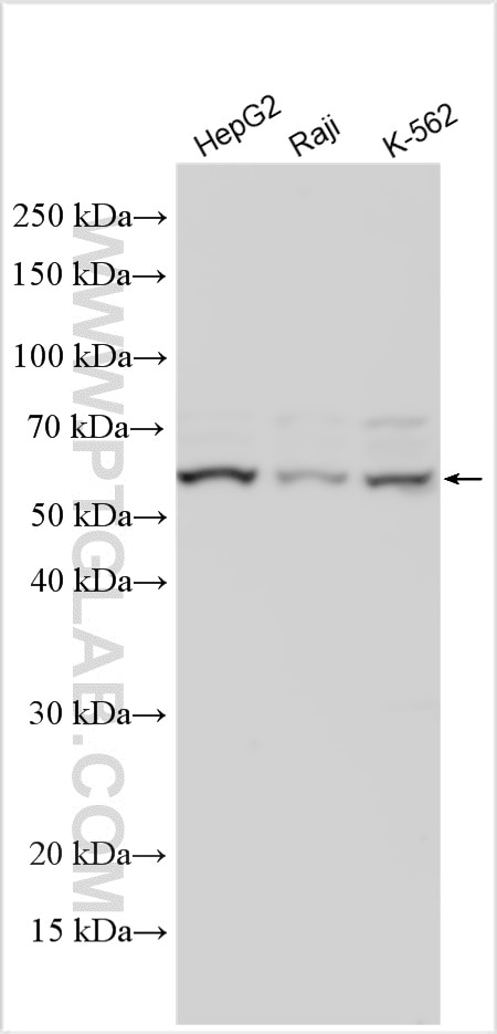 Western Blot (WB) analysis of various lysates using UCKL1 Polyclonal antibody (28762-1-AP)