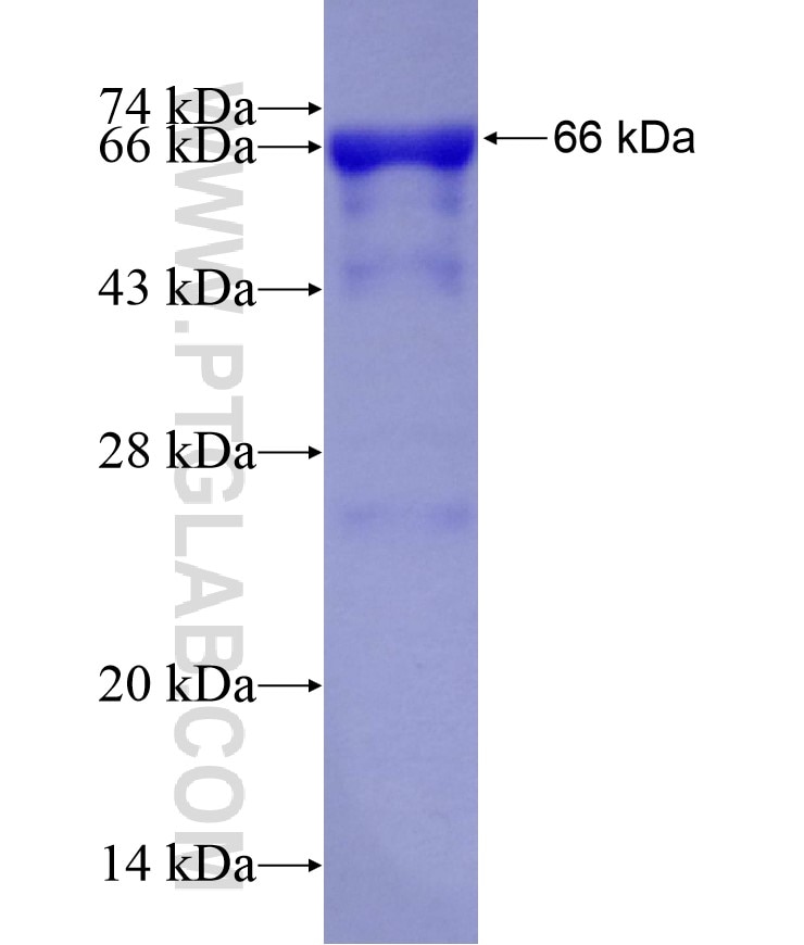 UCKL1 fusion protein Ag10701 SDS-PAGE