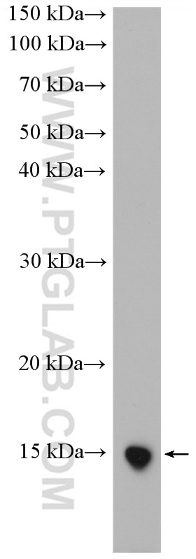 Western Blot (WB) analysis of mouse spleen tissue using UCMA Polyclonal antibody (25503-1-AP)