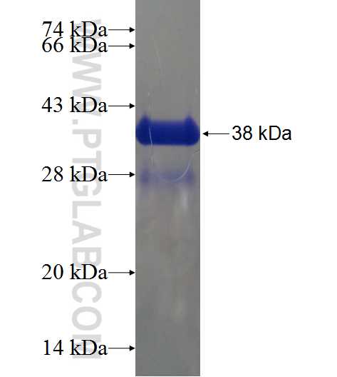 UCMA fusion protein Ag21985 SDS-PAGE