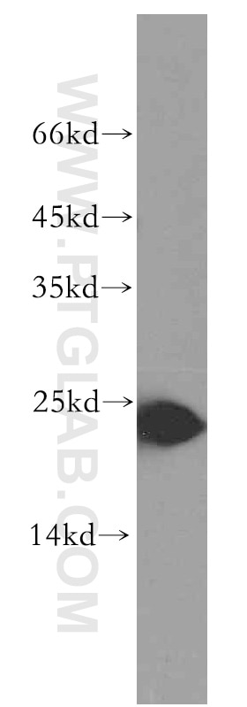 Western Blot (WB) analysis of HEK-293 cells using Urocortin Polyclonal antibody (19731-1-AP)