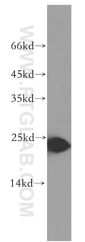 WB analysis of HEK-293 using 19731-1-AP