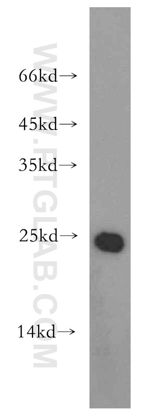 Western Blot (WB) analysis of human kidney tissue using Urocortin Polyclonal antibody (19731-1-AP)