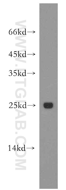 Western Blot (WB) analysis of human testis tissue using Urocortin Polyclonal antibody (19731-1-AP)