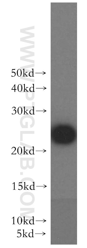 Western Blot (WB) analysis of HeLa cells using Urocortin Polyclonal antibody (19731-1-AP)