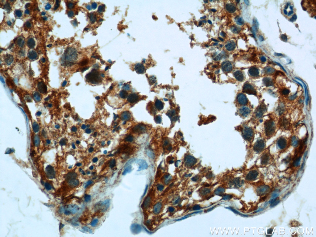 Urocortin