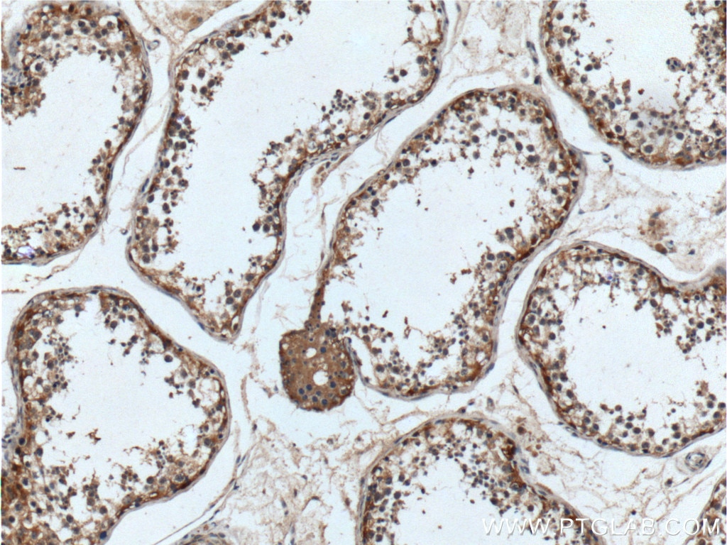 Immunohistochemistry (IHC) staining of human testis tissue using UCN Polyclonal antibody (21951-1-AP)