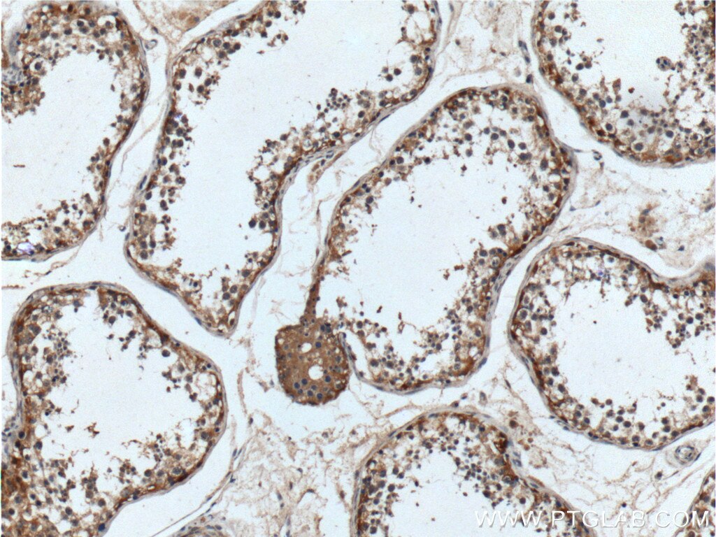 IHC staining of human testis using 21951-1-AP