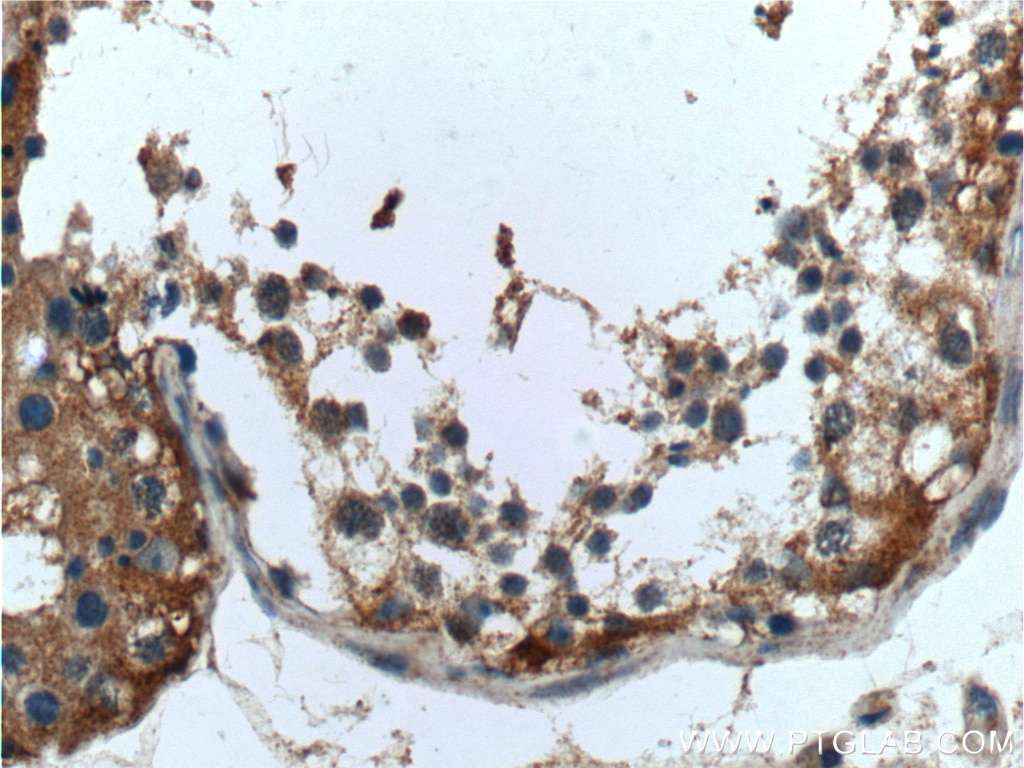 Immunohistochemistry (IHC) staining of human testis tissue using UCN Polyclonal antibody (21951-1-AP)