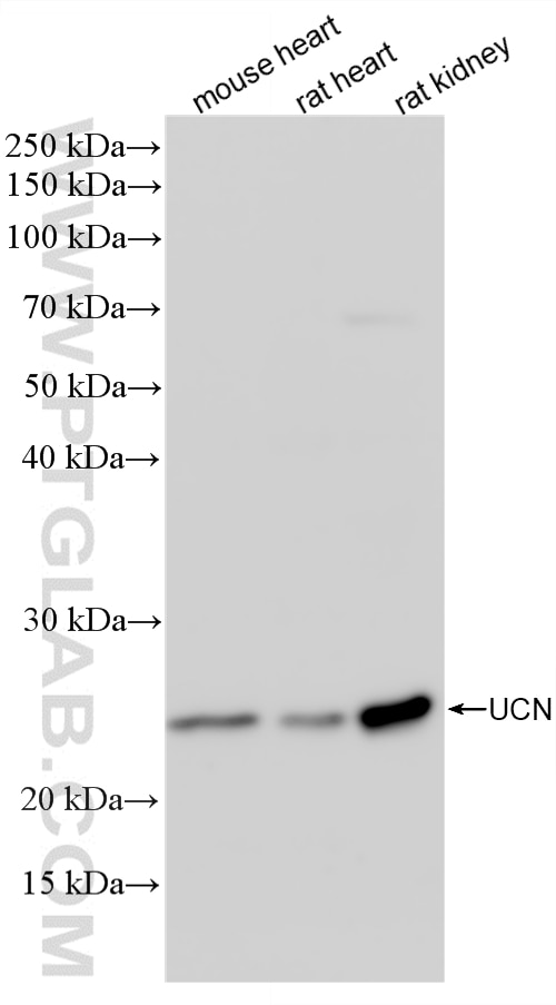 Western Blot (WB) analysis of various lysates using Urocortin Recombinant monoclonal antibody (84380-1-RR)
