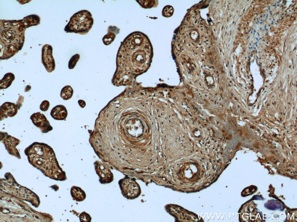 IHC staining of human placenta using 12198-1-AP
