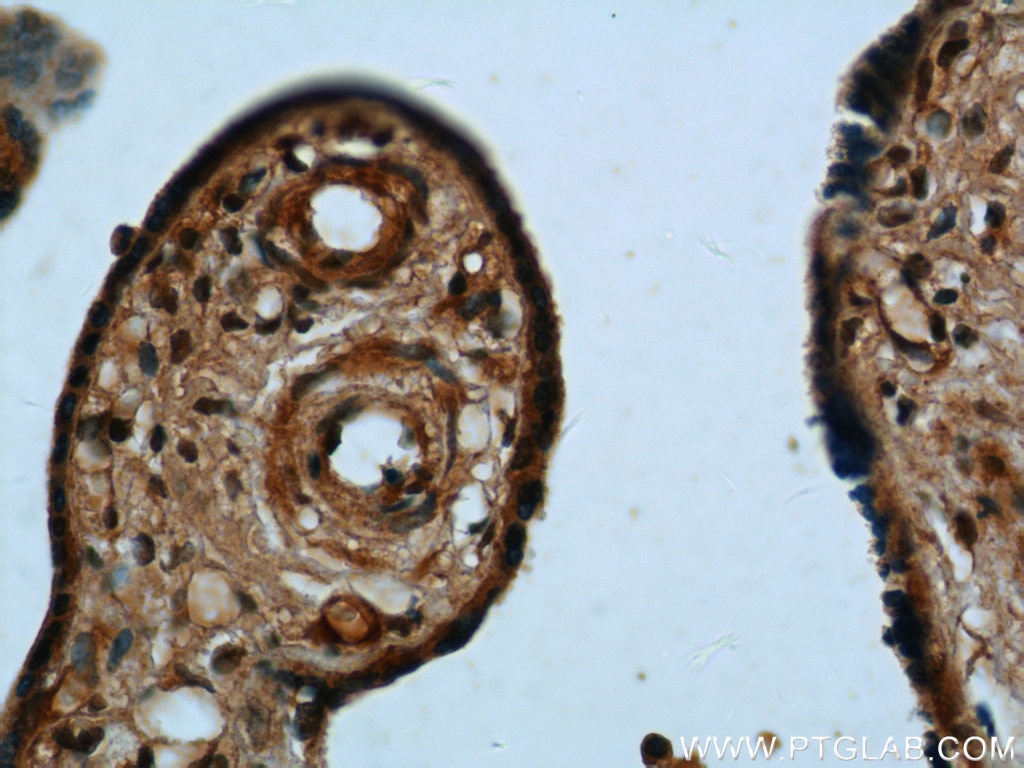 IHC staining of human placenta using 12198-1-AP