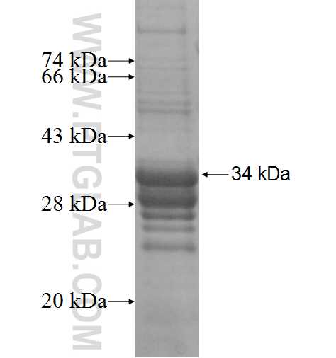 UCN2 fusion protein Ag2836 SDS-PAGE