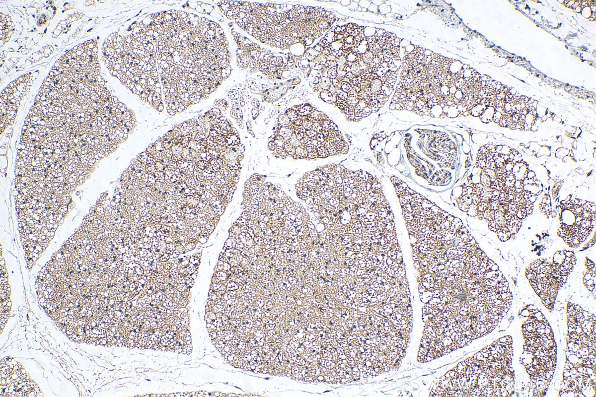 Immunohistochemistry (IHC) staining of mouse brown adipose tissue using UCP1 Polyclonal antibody (23673-1-AP)