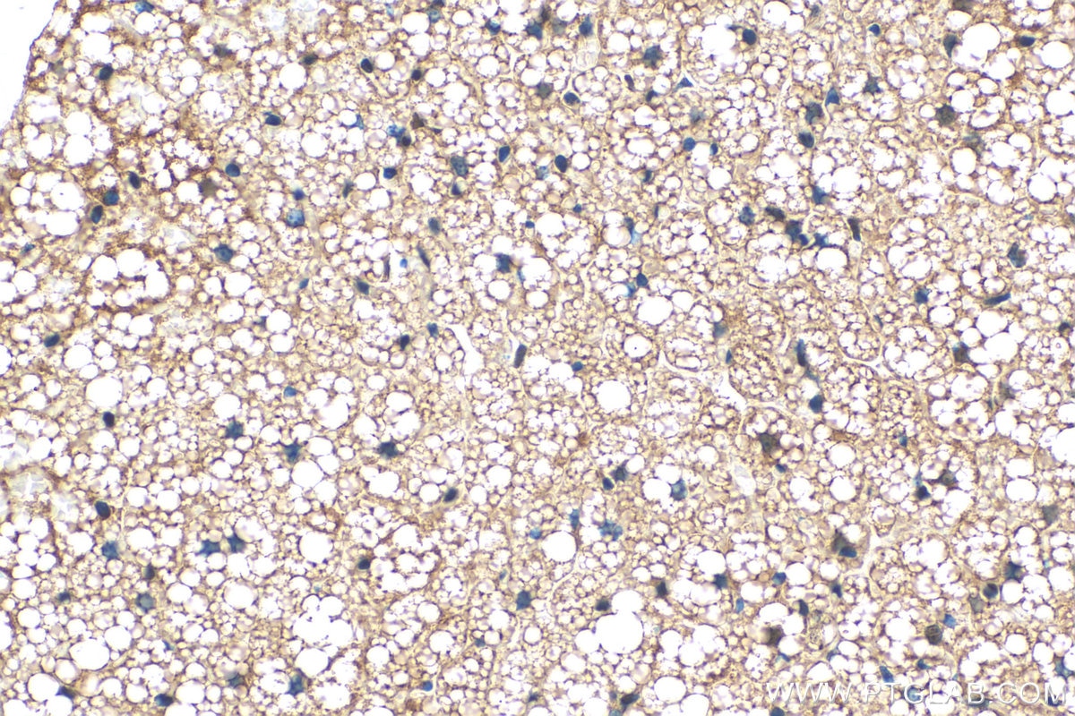 Immunohistochemistry (IHC) staining of mouse brown adipose tissue using UCP1 Polyclonal antibody (23673-1-AP)