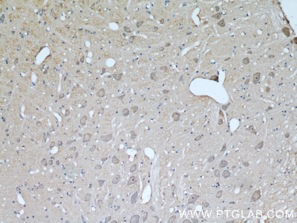 IHC staining of rat brain using 23673-1-AP