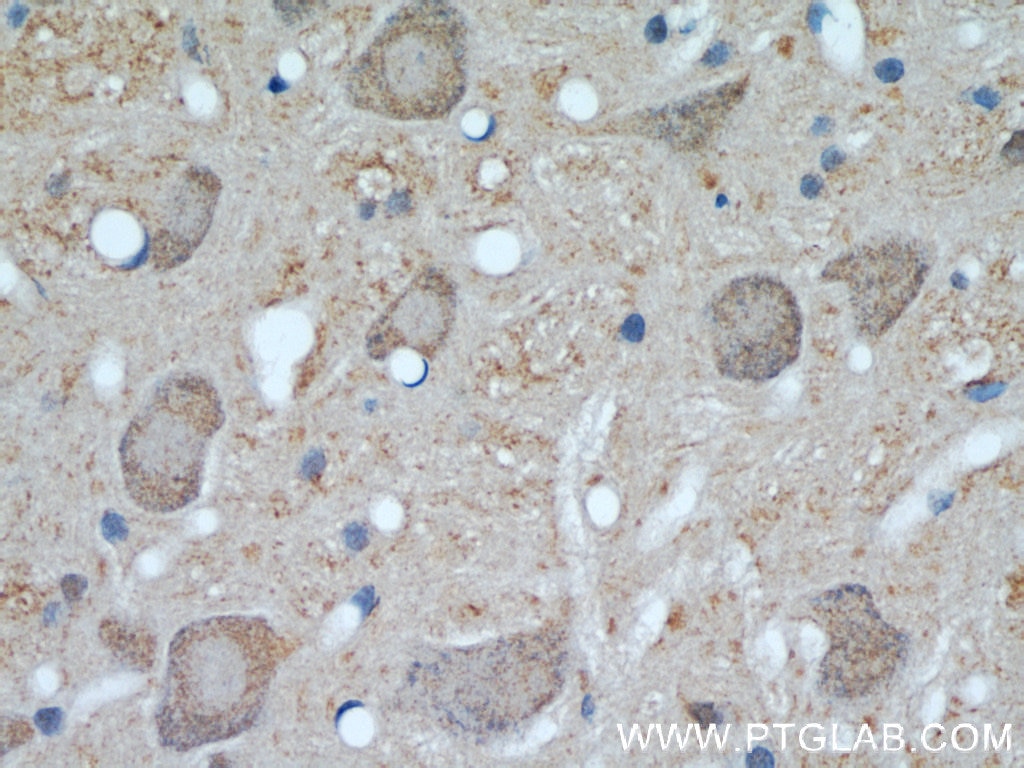 Immunohistochemistry (IHC) staining of rat brain tissue using UCP1 Polyclonal antibody (23673-1-AP)