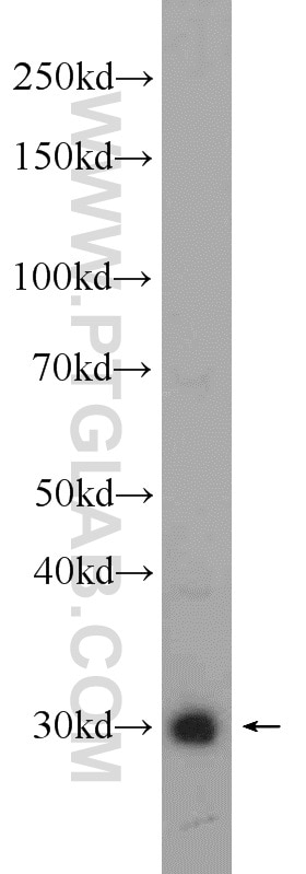 UCP1 Polyclonal antibody