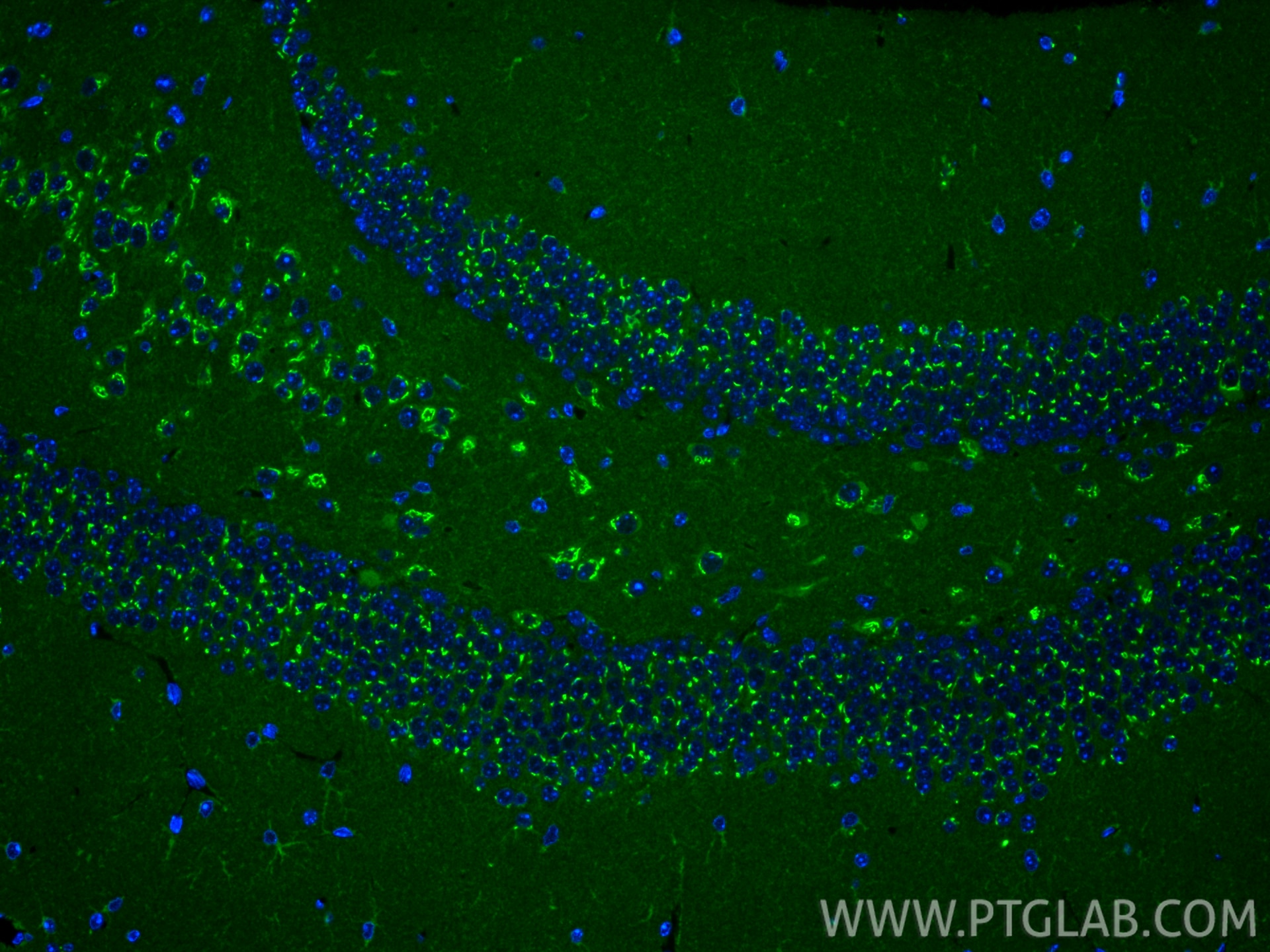 Immunofluorescence (IF) / fluorescent staining of mouse brain tissue using Multi-rAb® UCP1 Multi-Recombinant antibody (RMX00036)