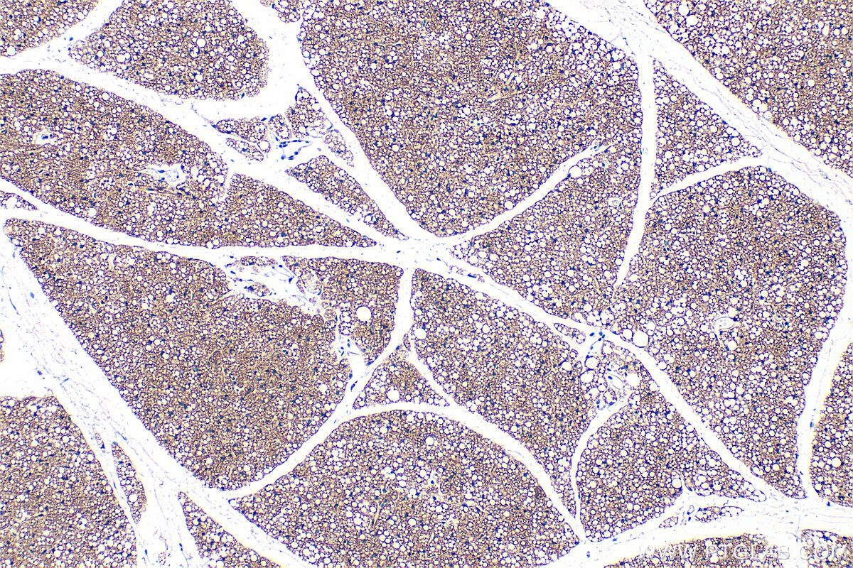 IHC staining of mouse brown adipose using RMX00036 Immunohistochemistry (IHC) staining of mouse brown adipose tissue using Multi-rAb® UCP1 Multi-Recombinant antibody (RMX00036)