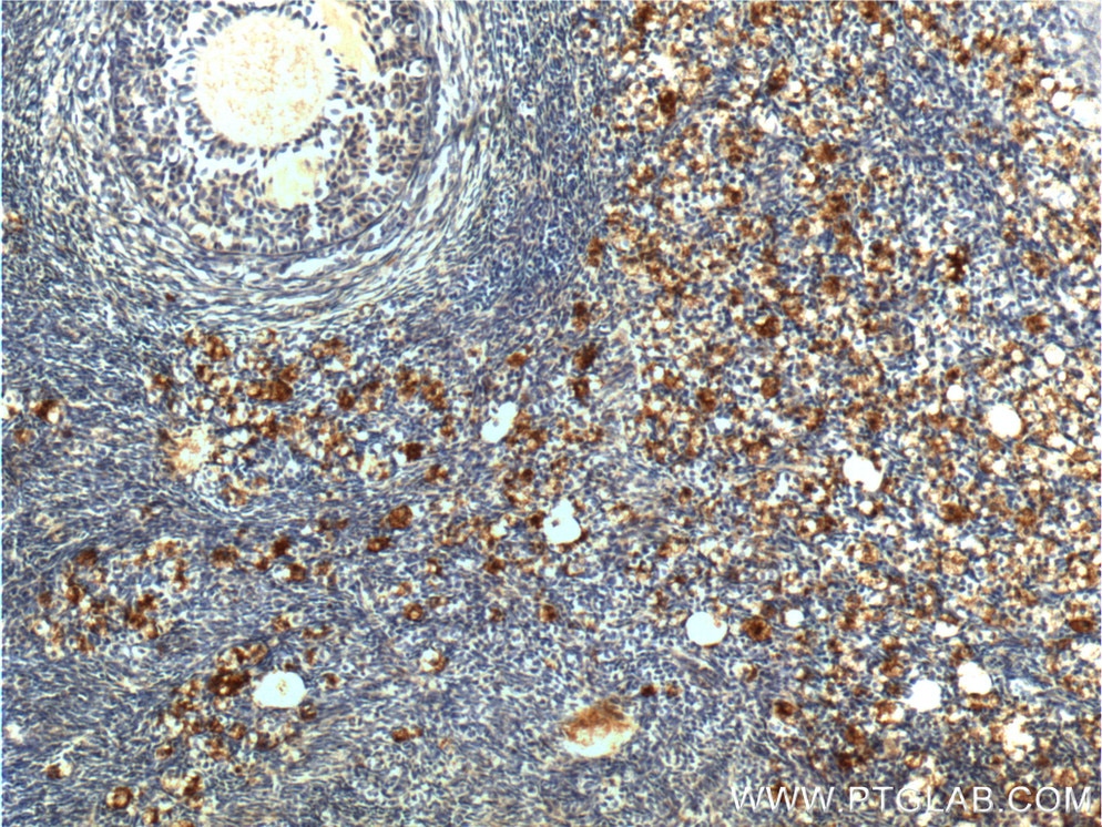 Immunohistochemistry (IHC) staining of human ovary tissue using UCP2 Polyclonal antibody (11081-1-AP)