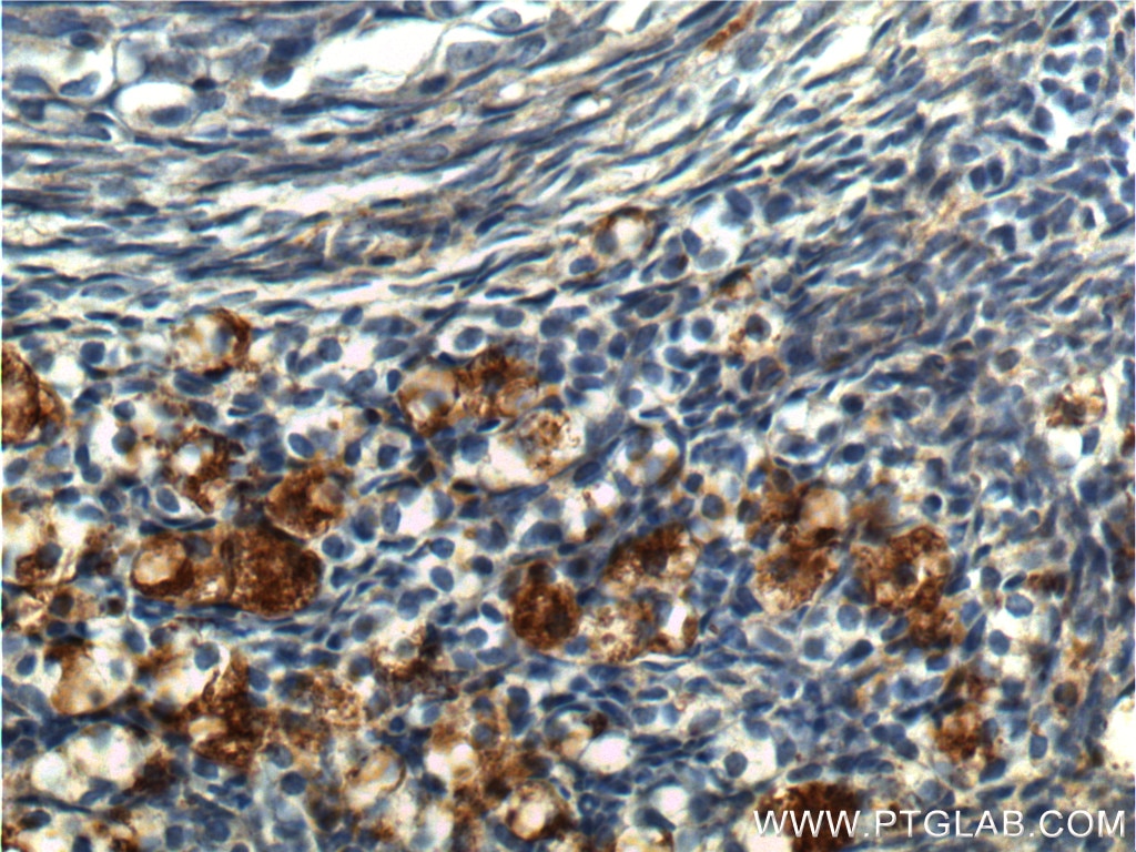 Immunohistochemistry (IHC) staining of human ovary tissue using UCP2 Polyclonal antibody (11081-1-AP)