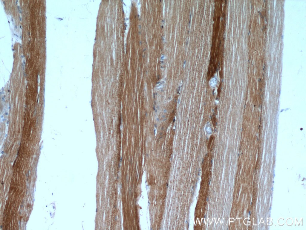 IHC staining of human skeletal muscle using 11081-1-AP