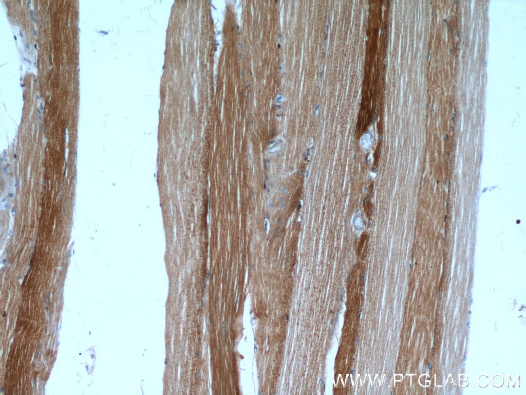 Immunohistochemistry (IHC) staining of human skeletal muscle tissue using UCP2 Polyclonal antibody (11081-1-AP)