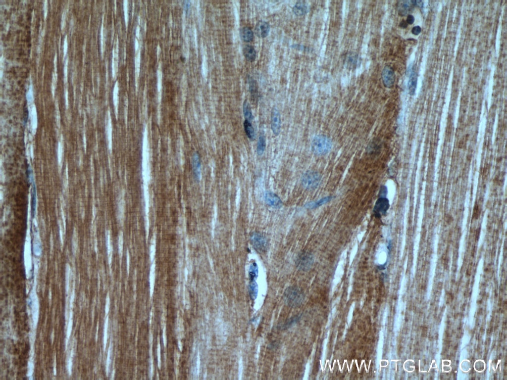 IHC staining of human skeletal muscle using 11081-1-AP