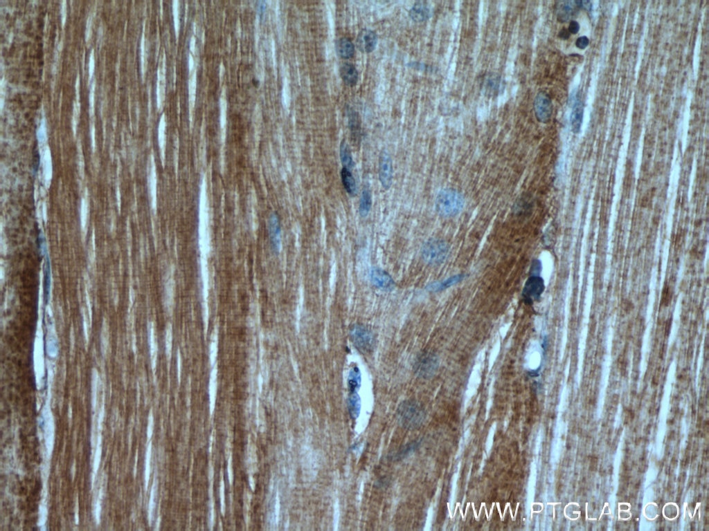 Immunohistochemistry (IHC) staining of human skeletal muscle tissue using UCP2 Polyclonal antibody (11081-1-AP)