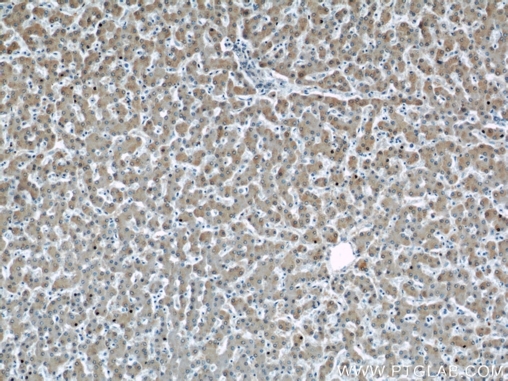 Immunohistochemistry (IHC) staining of human liver tissue using UCP2 Polyclonal antibody (11081-1-AP)